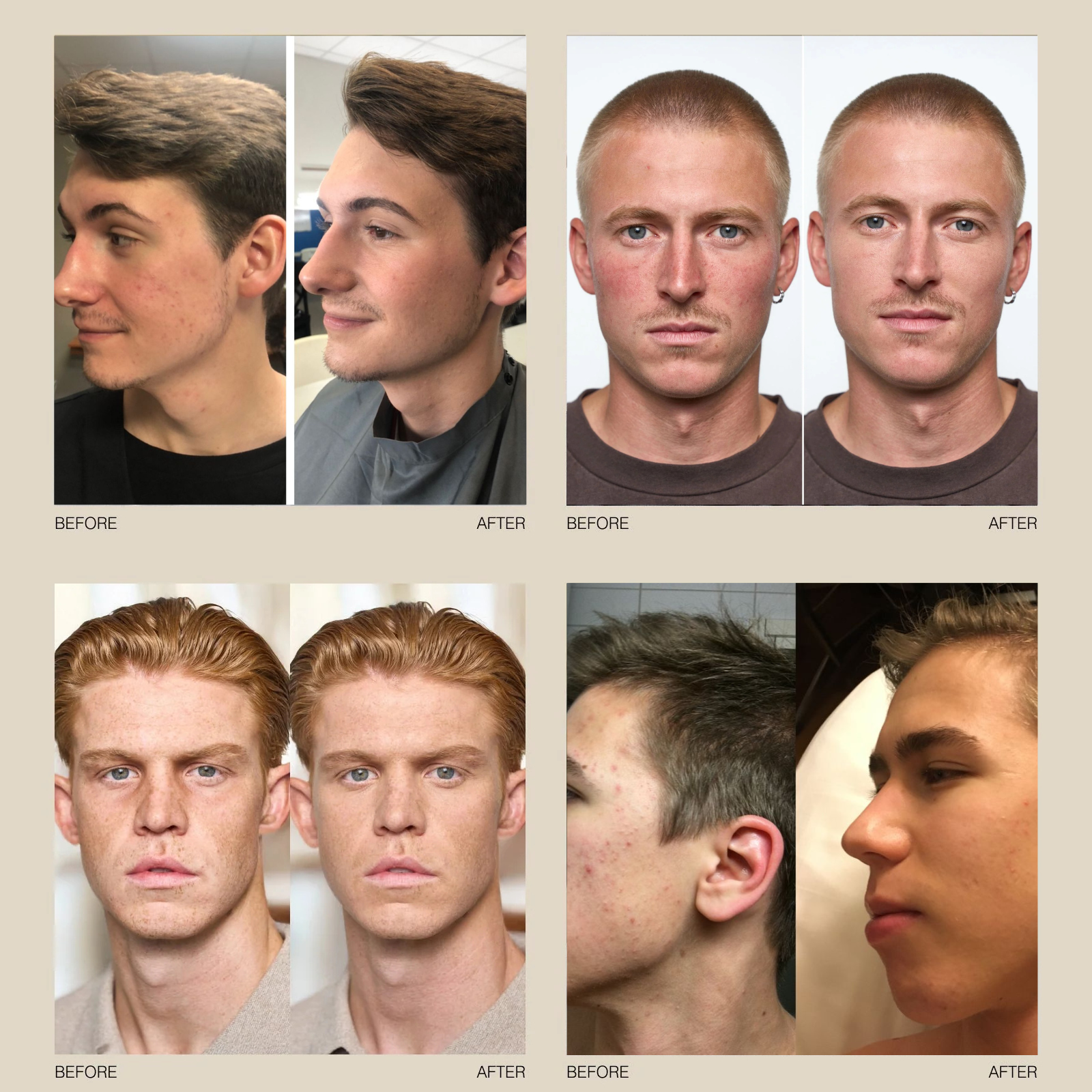 The Ascension Bundle